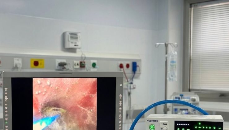Tavşanlı böbrek taşı tedavisinde kapalı yöntem konforuna kavuştu